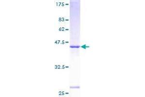 SAR1A Protein (AA 1-198) (GST tag)