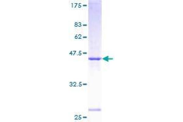 SAR1A Protein (AA 1-198) (GST tag)