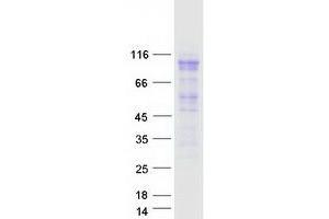 MCM4 Protein (Transcript Variant 1) (Myc-DYKDDDDK Tag)