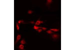 ABIN6272260 staining LOVO by IF/ICC. (C/EBP delta/epsilon antibody)