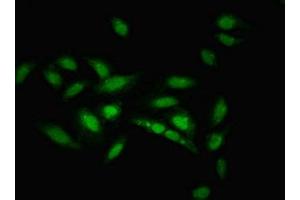 Immunofluorescent analysis of Hela cells using ABIN7176113 at dilution of 1:100 and Alexa Fluor 488-congugated AffiniPure Goat Anti-Rabbit IgG(H+L) (ZNF133 antibody  (AA 1-210))