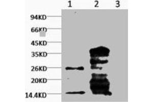 Western blot analysis of Hela, diluted at 1) 1:1000 2) 1:3000