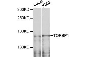 Western blot analysis of extracts of various cell lines, using TOPBP1 antibody. (TOPBP1 antibody)