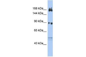 WB Suggested Anti-AFF2 Antibody Titration:  0. (AFF2 antibody  (N-Term))