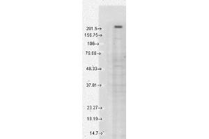 Western Blotting (WB) image for anti-Transient Receptor Potential Cation Channel, Subfamily M, Member 7 (TRPM7) (C-Term) antibody (ABIN6657588)