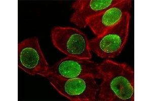 Fluorescent image of A549 cell stained with SUMO-1 antibody at 1:25. (SUMO1 antibody  (AA 1-30))