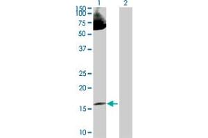 Western Blot analysis of LMO2 expression in transfected 293T cell line by LMO2 MaxPab polyclonal antibody.
