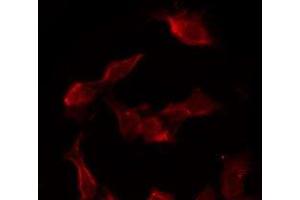 ABIN6276721 staining COS-7 by IF/ICC. (CST3 antibody)