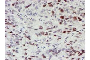 Image no. 1 for anti-Myeloid Leukemia Factor 1 (MLF1) antibody (ABIN1499495) (MLF1 antibody)