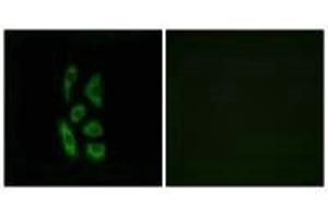 Immunofluorescence analysis of A549 cells, using ACOT12 antibody. (ACOT12 antibody)