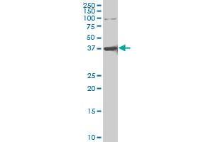 FOXQ1 polyclonal antibody (A01), Lot # ABNOVA051128QCS1 Western Blot analysis of FOXQ1 expression in Hela S3 NE . (FOXQ1 antibody  (AA 110-219))