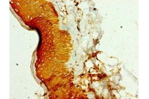 Immunohistochemistry of paraffin-embedded human skin tissue using ABIN7169410 at dilution of 1:100 (SMYD4 antibody  (AA 1-260))