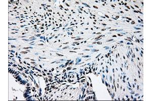 Immunohistochemical staining of paraffin-embedded pancreas tissue using anti-BRAFmouse monoclonal antibody.