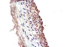 Formalin-fixed and paraffin embedded rat carotid artery Anti-MMP-2 Polyclonal Antibody , Unconjugated at 1:200, followed by conjugation to the secondary antibody and DAB staining. (MMP2 antibody  (AA 31-109))