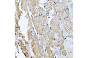 Immunohistochemistry of paraffin-embedded rat heart using CCM2 antibody. (CCM2 antibody  (AA 1-300))