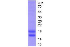 Image no. 1 for Cytochrome P450, Family 1, Subfamily B, Polypeptide 1 (CYP1B1) (AA 374-516) (Active) protein (His tag) (ABIN6239886) (CYP1B1 Protein (AA 374-516) (His tag))