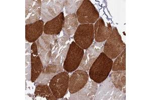 Immunohistochemical staining of human skeletal muscle with ANKRD2 polyclonal antibody  shows strong cytoplasmic positivity in myocytes at 1:500-1:1000 dilution.
