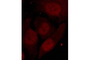 Immunofluorescence staining of methanol-fixed Hela cells showing nuclear staining using HDAC2(Phospho-Ser394) Antibody. (HDAC2 antibody  (pSer394))