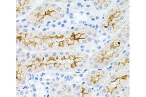 Immunohistochemistry of paraffin-embedded Mouse kidney using IL17A Polyclonal Antibody at dilution of 1:100 (40x lens). (Interleukin 17a antibody)