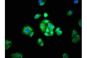 Immunofluorescence staining of HepG2 cells with ABIN7143641 at 1:66, counter-stained with DAPI. (ADH1A antibody  (AA 104-253))