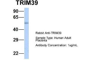 Host:  Rabbit  Target Name:  TRIM39  Sample Type:  Human Adult Placenta  Antibody Dilution:  1.