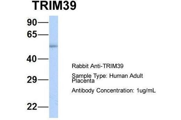 TRIM39 Antikörper  (Middle Region)