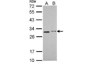 WB Image SDHB antibody [C2C3], C-term detects SDHB protein by Western blot analysis. (SDHB antibody  (C-Term))