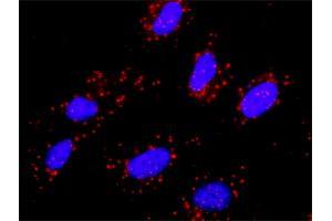Proximity Ligation Analysis of protein-protein interactions between CBL and MET. (c-MET antibody  (AA 1-1390))