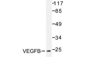 Image no. 1 for anti-Vascular Endothelial Growth Factor B (VEGFB) antibody (ABIN271976)