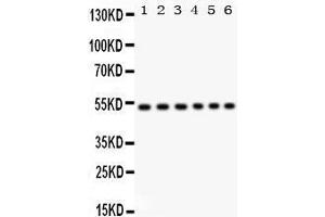 Western Blotting (WB) image for anti-Unc-51-Like Kinase 3 (ULK3) (AA 427-454), (C-Term) antibody (ABIN3043954) (ULK3 antibody  (C-Term))