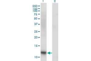 Western Blot analysis of SNAPC5 expression in transfected 293T cell line by SNAPC5 monoclonal antibody (M03), clone 5E2. (SNAPC5 antibody  (AA 1-68))