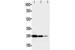 Anti-TNF Receptor I antibody, Western blotting Lane 1: Recombinant Human TNFR1 Protein 10ng Lane 2: Recombinant Human TNFR1 Protein 5ng Lane 3: Recombinant Human TNFR1 Protein 2.