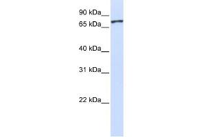 WB Suggested Anti-UNC5A Antibody Titration:  0. (UNC5A antibody  (Middle Region))