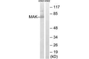 Western blot analysis of extracts from K562 cells, using MAK (Ab-159) Antibody.