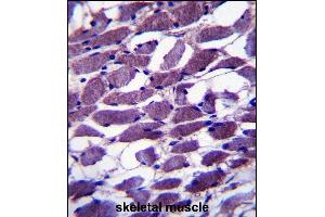 MYOM1 Antibody (Center) (ABIN657367 and ABIN2846414) immunohistochemistry analysis in formalin fixed and paraffin embedded human skeletal muscle followed by peroxidase conjugation of the secondary antibody and DAB staining. (Myomesin 1 antibody  (AA 904-933))