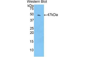 Western blot analysis of the recombinant protein. (TIMP4 antibody  (AA 10-170))