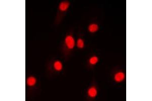 Immunofluorescent analysis of NF-kappaB p100 (pS865) staining in HepG2 cells. (NFKB2 antibody  (C-Term, pSer865))