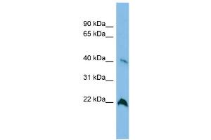 WB Suggested Anti-TGDS Antibody Titration: 0. (TGDS antibody  (Middle Region))