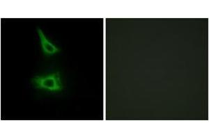 Immunofluorescence analysis of HeLa cells, using CDH17 Antibody. (LI Cadherin antibody  (AA 341-390))