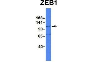 Western Blotting (WB) image for anti-Zinc Finger E-Box Binding Homeobox 1 (ZEB1) (N-Term) antibody (ABIN2779631)