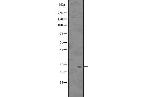 Western blot analysis of Rab9 using 293 whole cell lysates (RAB9A antibody  (Internal Region))