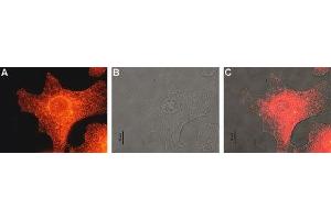 Expression of MC1R in human Malme-3M cells - Immunocytochemical staining of human paraformaldehyde fixed and permeabilized malignant melanoma cell lines (Malme-3M). (MC1 Receptor antibody  (AA 217-232))
