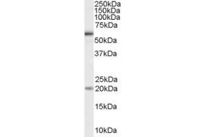 ABIN185608 (1µg/ml) staining of HeLa cell lysate (35µg protein in RIPA buffer). (BMPR1A antibody  (Internal Region))
