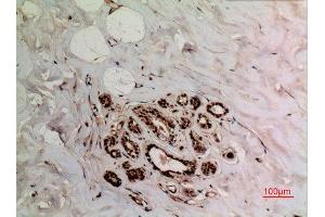 Immunohistochemistry (IHC) image for anti-X-Ray Repair Complementing Defective Repair in Chinese Hamster Cells 6 (XRCC6) (acLys539) antibody (ABIN3181889)