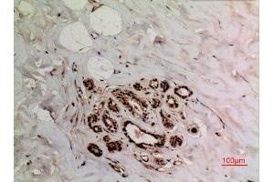 Immunohistochemistry (IHC) analysis of paraffin-embedded Human Breast, antibody was diluted at 1:100. (XRCC6 antibody  (acLys539))