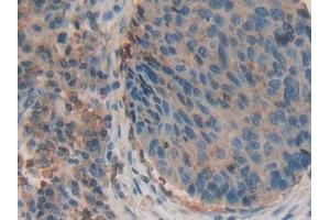 Immunohistochemistry (IHC) image for anti-beta-2-Microglobulin (B2M) (AA 22-119) antibody (ABIN7429220)
