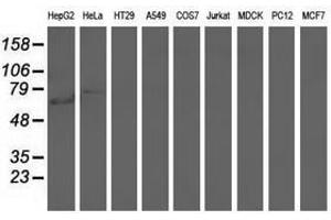 Image no. 1 for anti-rho GTPase Activating Protein 25 (ARHGAP25) antibody (ABIN1496709)