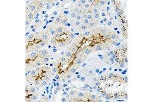 Immunohistochemical analysis of TGF beta 2 staining in human kidney formalin fixed paraffin embedded tissue section.