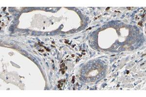 ABIN6277345 at 1/100 staining Human prostate tissue by IHC-P. (USO1 antibody  (C-Term))