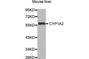 Western Blotting (WB) image for anti-Cytochrome P450, Family 1, Subfamily A, Polypeptide 2 (CYP1A2) (AA 205-305) antibody (ABIN6213604) (CYP1A2 antibody  (AA 205-305))